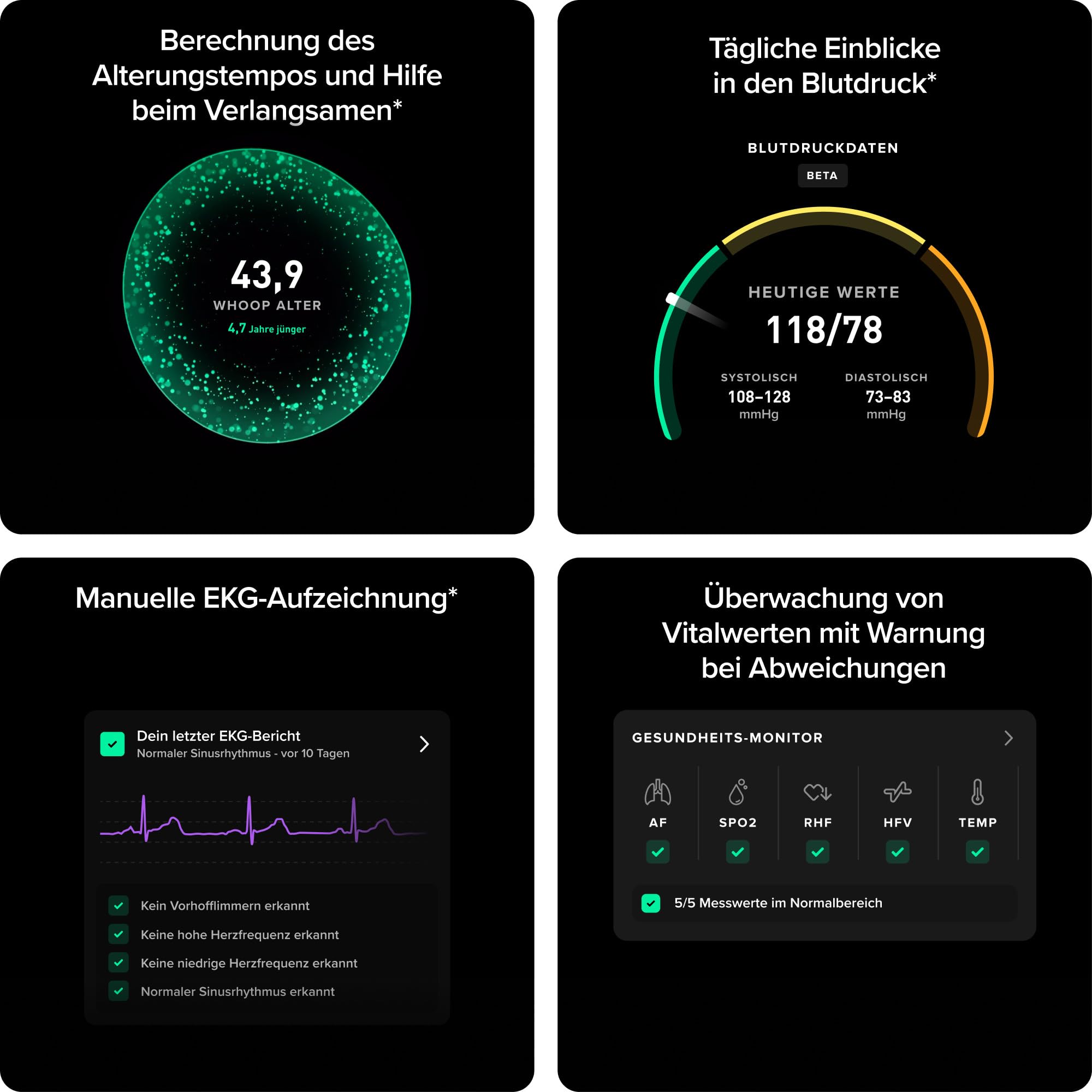WHOOP 5.0 MG Aktivitätstracker, 12 Monate Mitgliedschaft, Fitness und Schlaftracking, persönliches Coaching