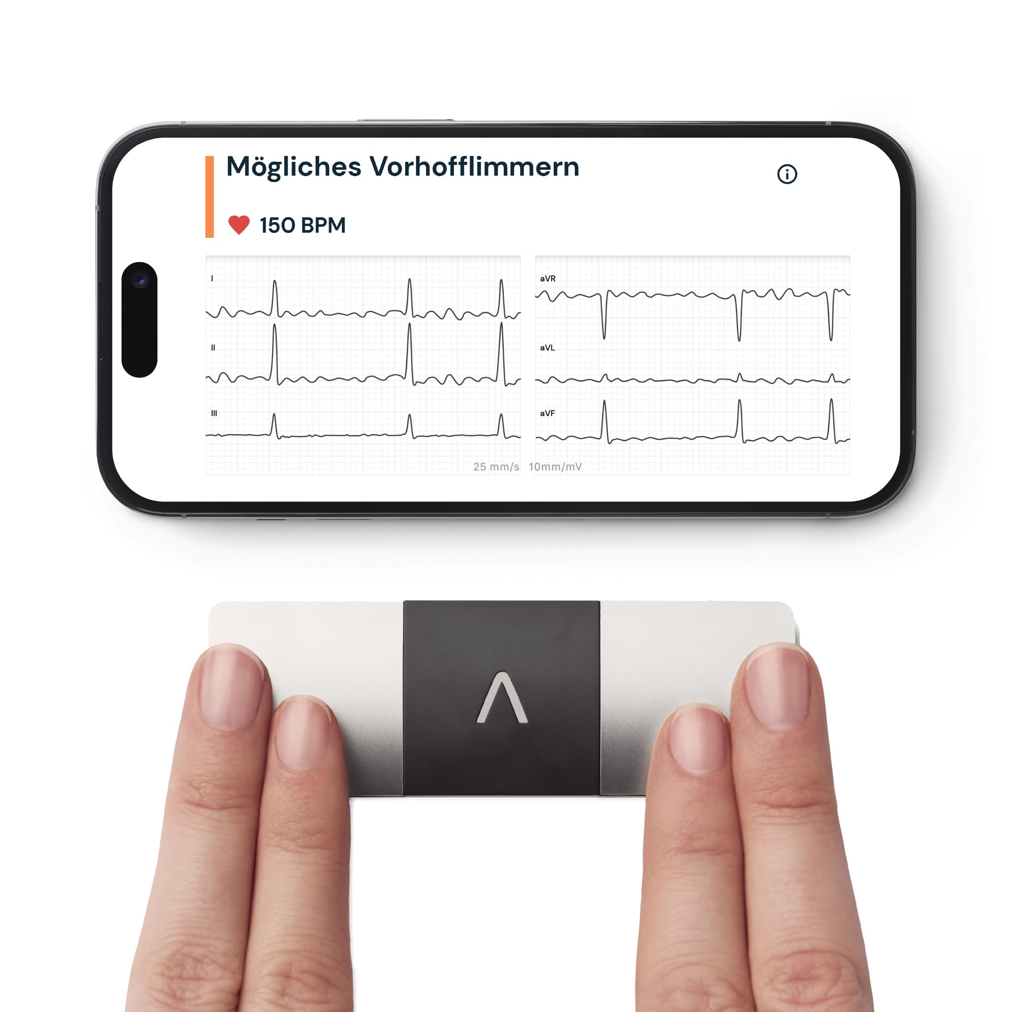 AliveCor KardiaMobile 6 Kanal EKG Herzfrequenzmonitor sechs Herzansichten erkennt Vorhofflimmern schnelle Ergebnisse