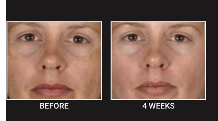 ARA Vitamin C Cream Oil Moisturizer