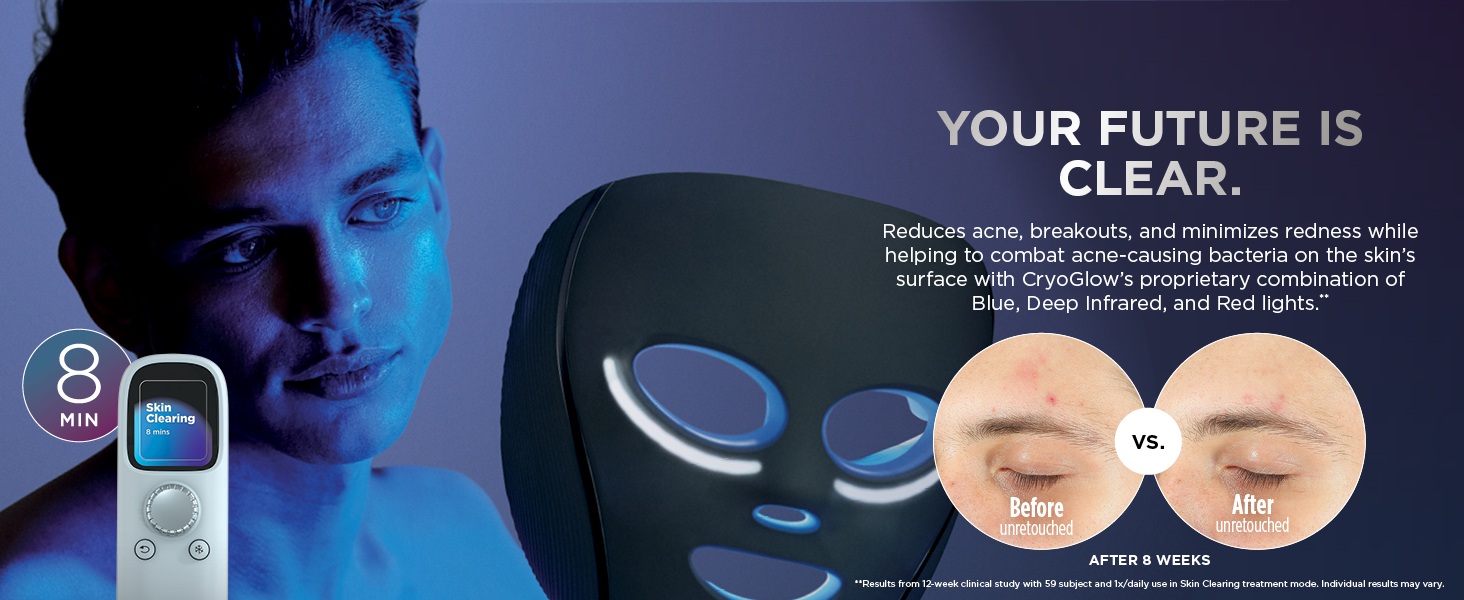 Shark Cryoglow; Skincare; device