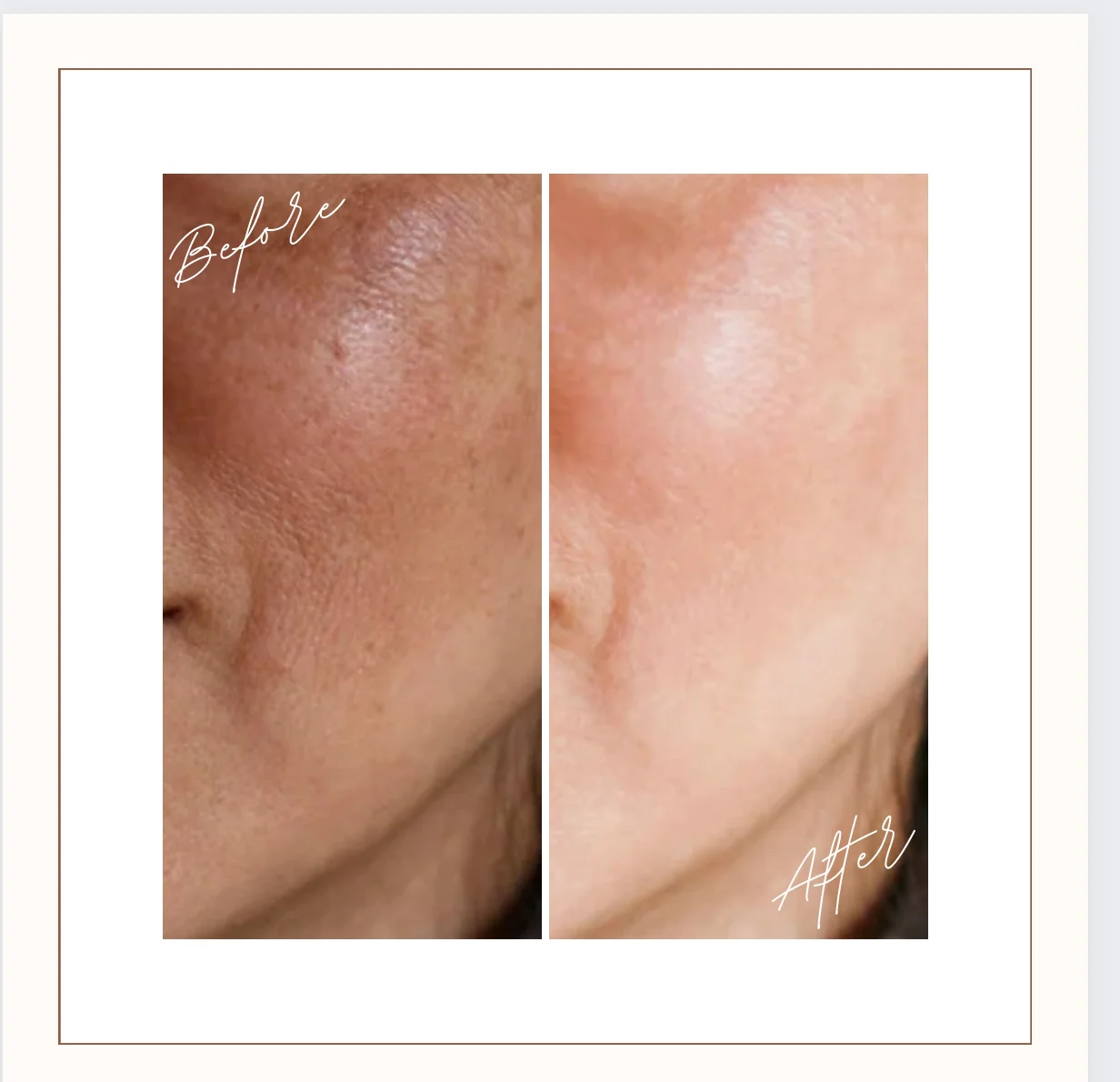 Ara Exfoliating Treatment