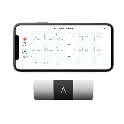 AliveCor KardiaMobile 6L ECG di livello medico | L’ECG Portatile a 6 Derivazioni | Rileva la Fibrillazione Atriale, Bradicardia e Tachicardia in Soli 30 Secondi | Distribuito da OMRON : Amazon.it: Commercio, Industria e Scienza