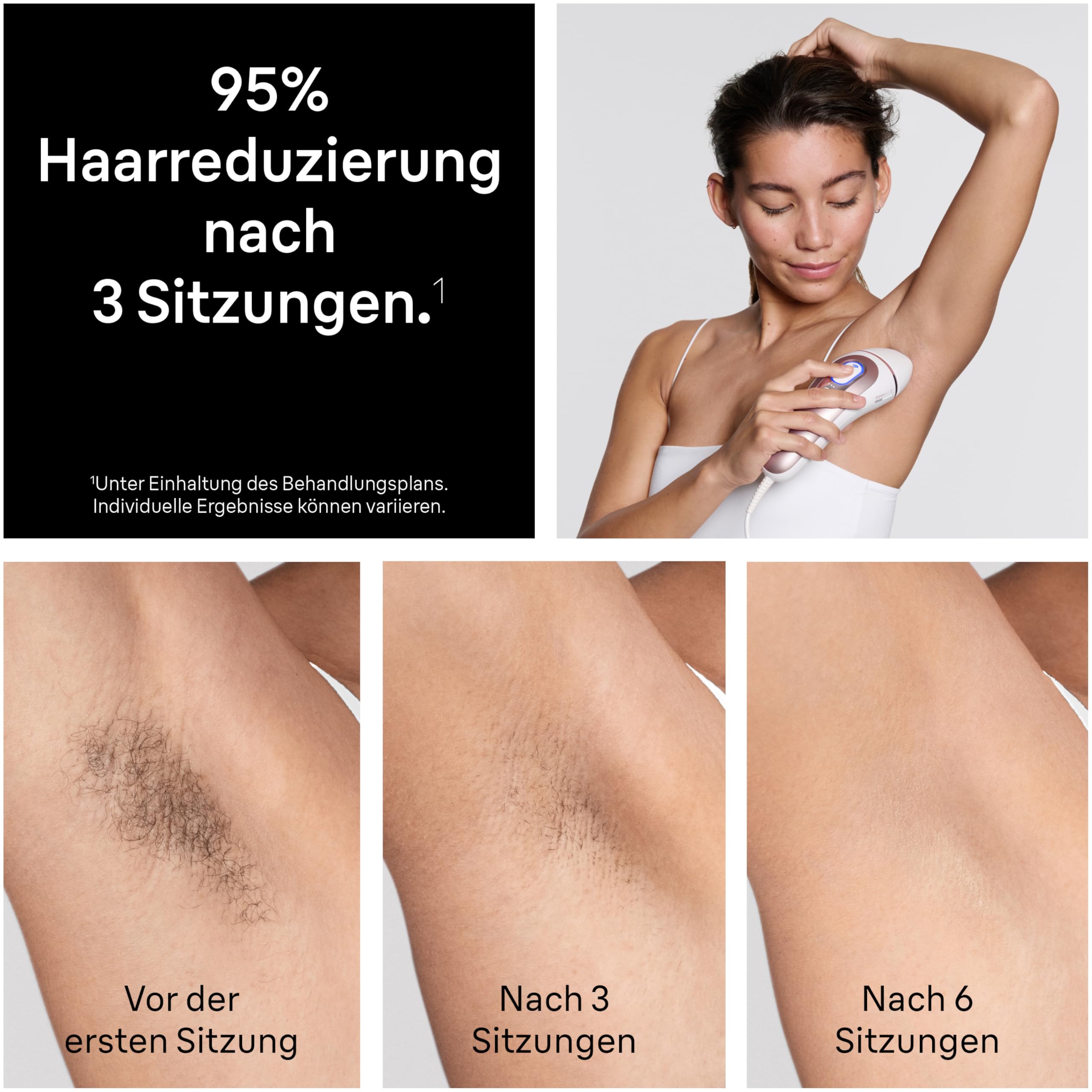 IPL Haarentfernungsgerät Skin i·expert 7 PL7311 mit Smart Flex Aufsatz, 2 Aufsätzen und Rasierer